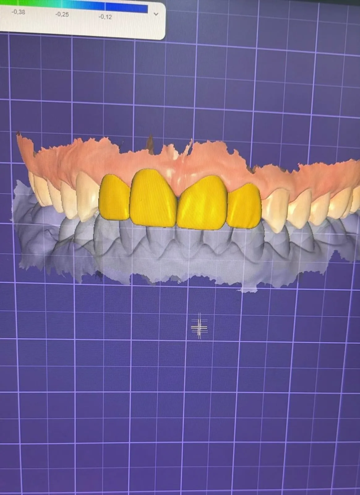 Conception numérique — Digital Smile Design